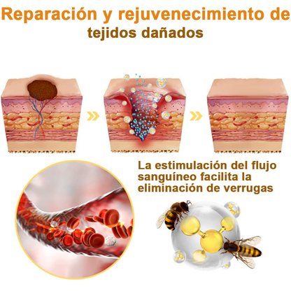 flysmus™Crema integral contra el veneno de abeja